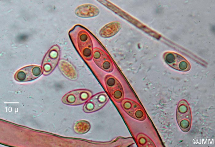 Octospora ithacaensis : microscopie