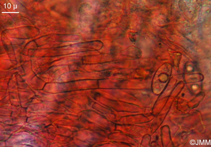 Octospora ithacaensis : microscopie