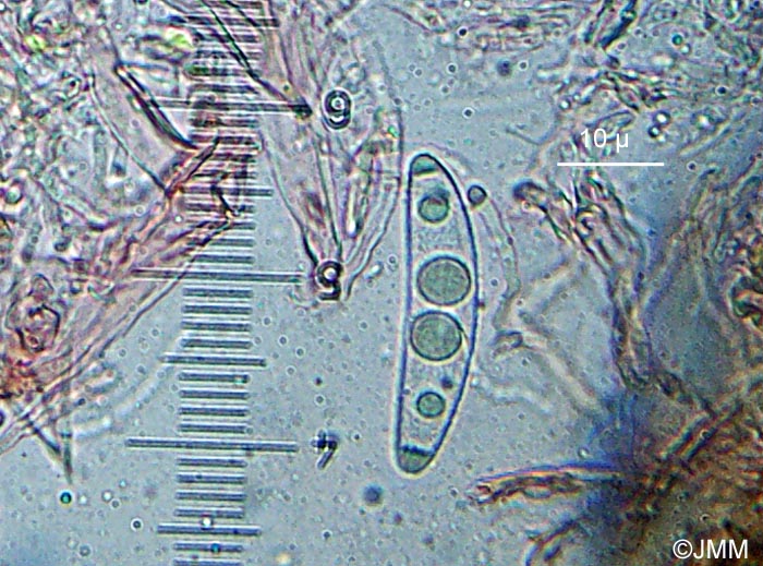 Octosporella ornithocephala : microscopie