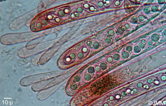 Pachyella babingtonii : microscopie