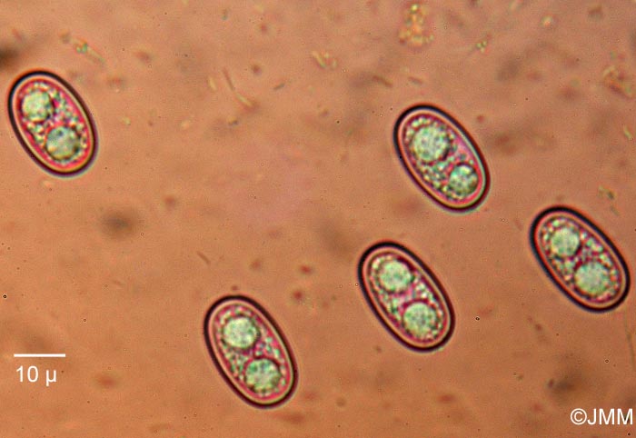 Pachyella babingtonii : microscopie