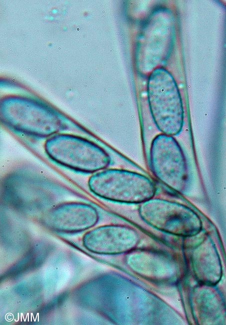 Peziza echinospora : spores
