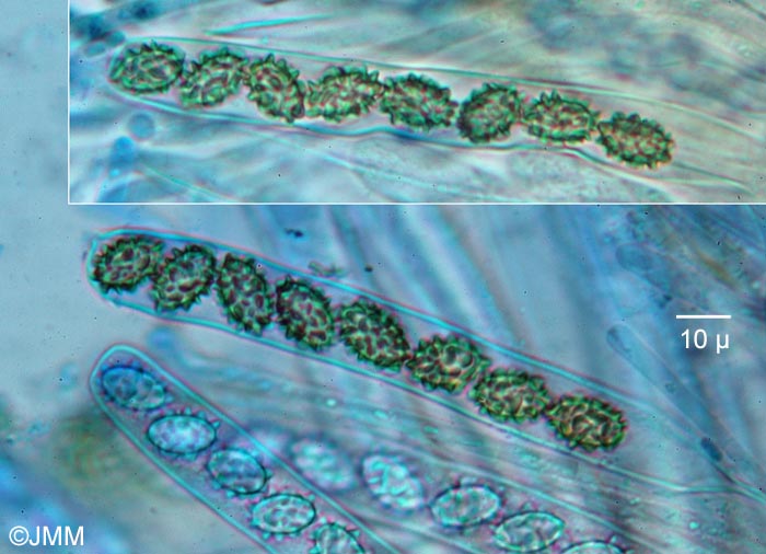 Peziza vacini : microscopie