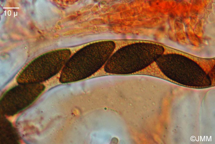 Phaeobotryosphaeria visci : asque et spores