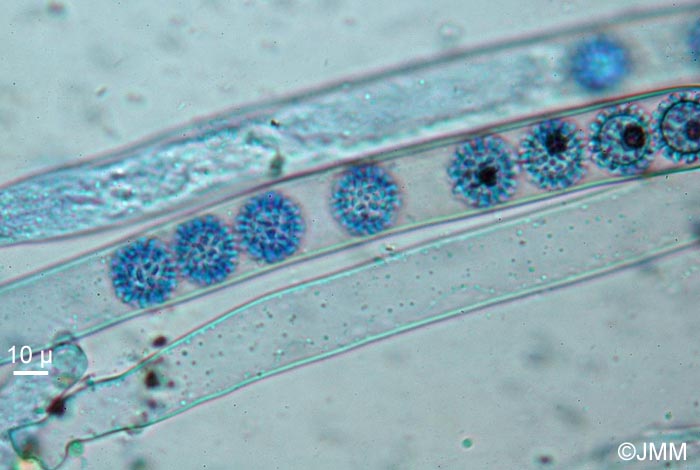 Plicaria carbonaria : microscopie
