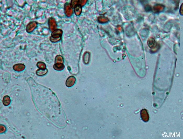 Psathyrella lutensis : microscopie