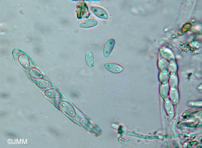 Pseudopeziza trifolii : spores et asques