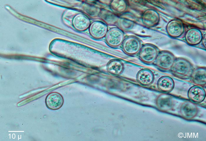Pseudoplectania ericae : asques, spores & paraphyses bifides