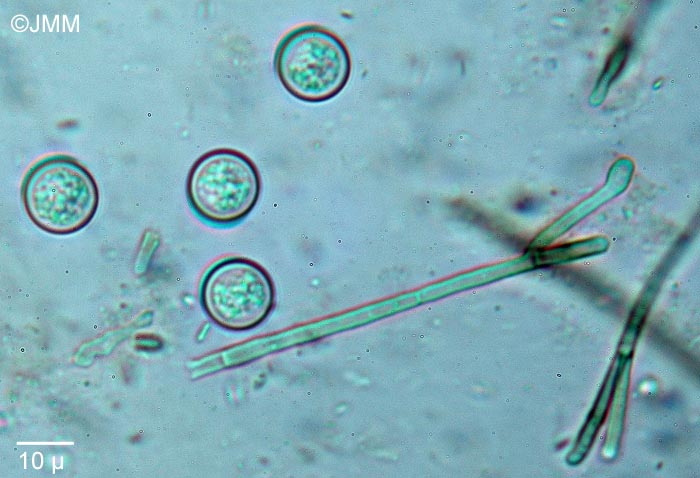 Pseudoplectania ericae : spores & paraphyses bifides