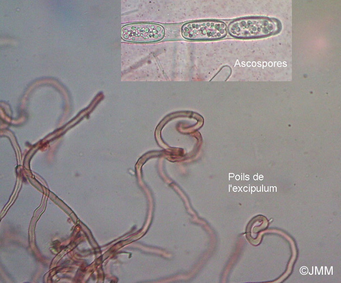 Sarcoscypha austriaca : microscopie