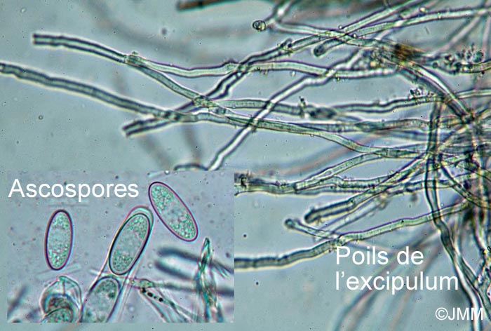 Sarcoscypha coccinea : microscopie