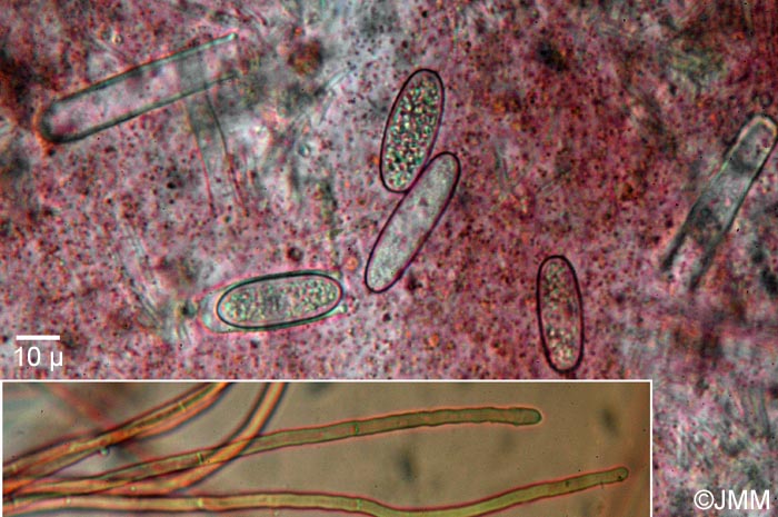Sarcoscypha coccinea : microscopie