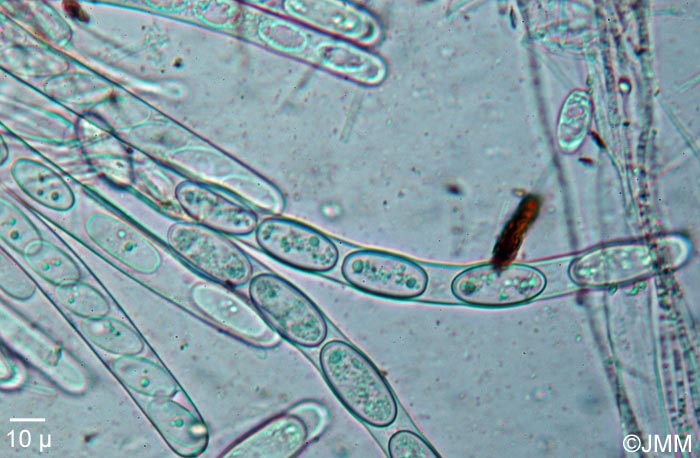 Sarcoscypha macaronesica : asques & ascospores