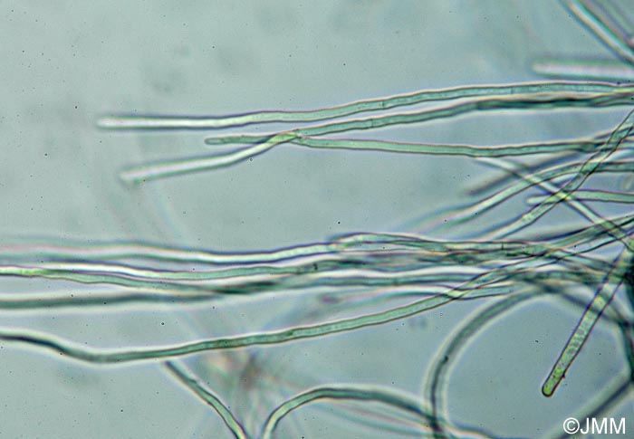 Sarcoscypha macaronesica : poils de l'excipulum