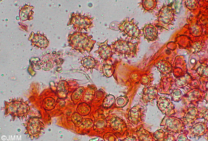 Stephanospora caroticolor : spores