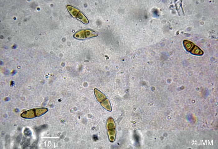 Immotthia atrograna