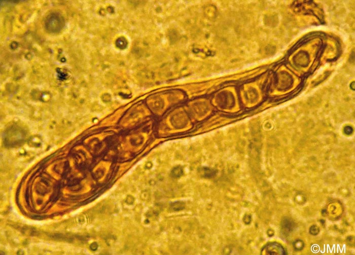 Immotthia atrograna