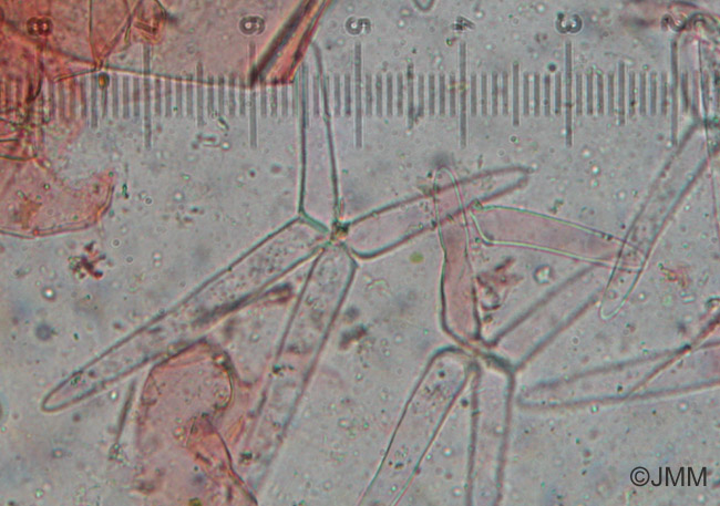 Utricularia stygia : microscopie des poils de l'intrieur des utricules